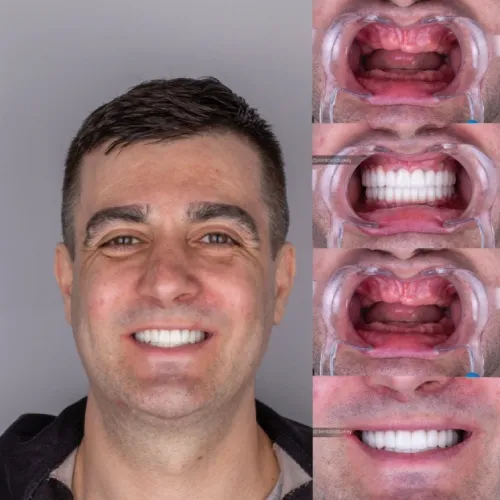 Patient 2 After Treatment