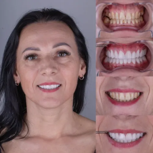 Patient 3 After Treatment