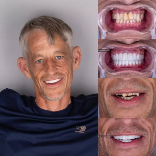 Patient 4 After Treatment