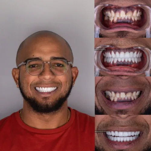 Patient 5 After Treatment