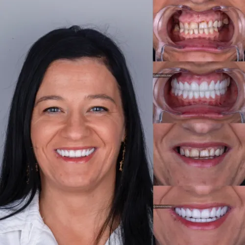 Patient 6 After Treatment